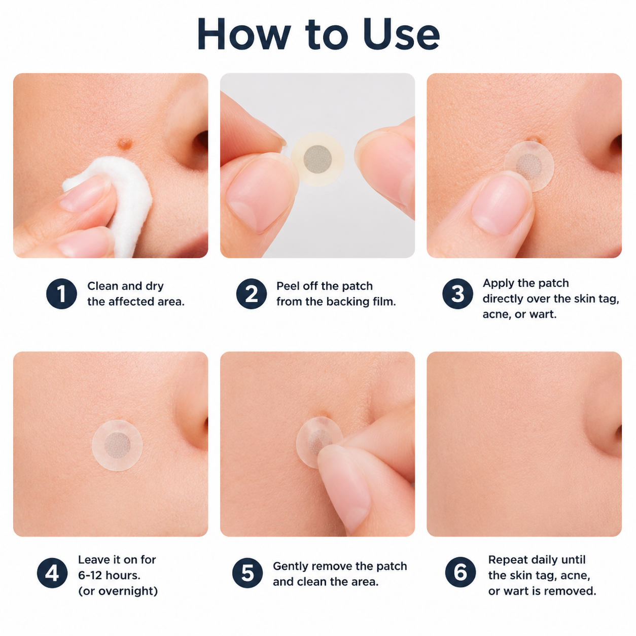 ✨2-in-1 Microneedle & Hydrocolloid Patch🍀| Removes Raised Moles, Acne, Flat Warts & Skin Tags | Helps Improve Wrinkles, Scars & Blemishes | Invisible Patches for Face & Body-CU