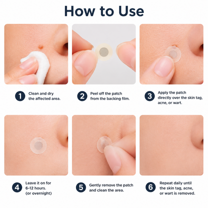 ✨2-in-1 Microneedle & Hydrocolloid Patch🍀| Removes Raised Moles, Acne, Flat Warts & Skin Tags | Helps Improve Wrinkles, Scars & Blemishes | Invisible Patches for Face & Body-ZDJ