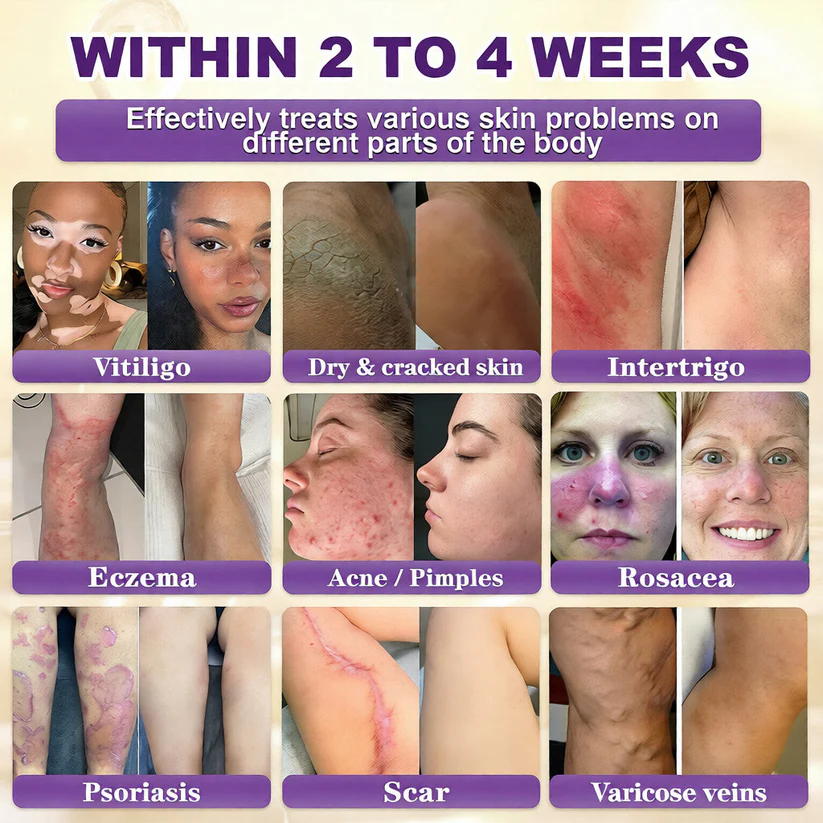 10-in-1 Skin Restoration Cream | Fixes 10+ Stubborn Skin Concerns At Once-ZDJ