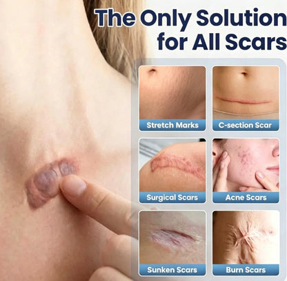 🏆 Advanced Scar Repair Cream – Fade the Look of Scars & Restore Smooth, Healthy-Looking Skin ✨-CU