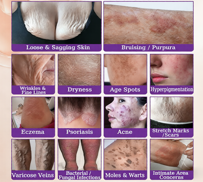 10-in-1 Skin Restoration Cream | Fixes 10+ Stubborn Skin Concerns At Once-ZDJ