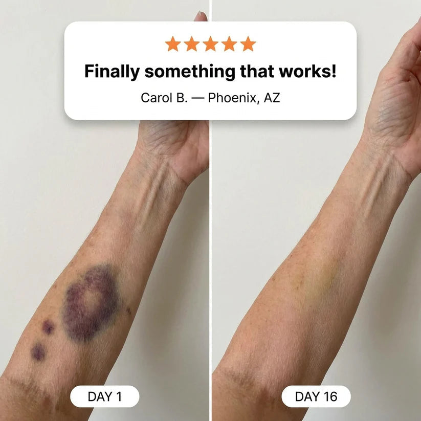 MAIAKOO Bruise Repair & Skin-Strengthening Cream - Image 2