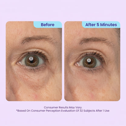 SPECIAL LAUNCH PRICE | GOPURE™ Instant Lift Eye Gel | For Puffiness & Bags, Wrinkles, Fine Lines and Dark Circles