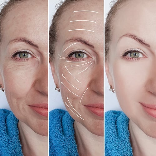 Peptide-Infused Overnight Face & Eye Smoothing Tape-ZDJ