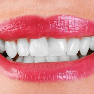 Pure'Aera Purple Mouthwash™ image 9