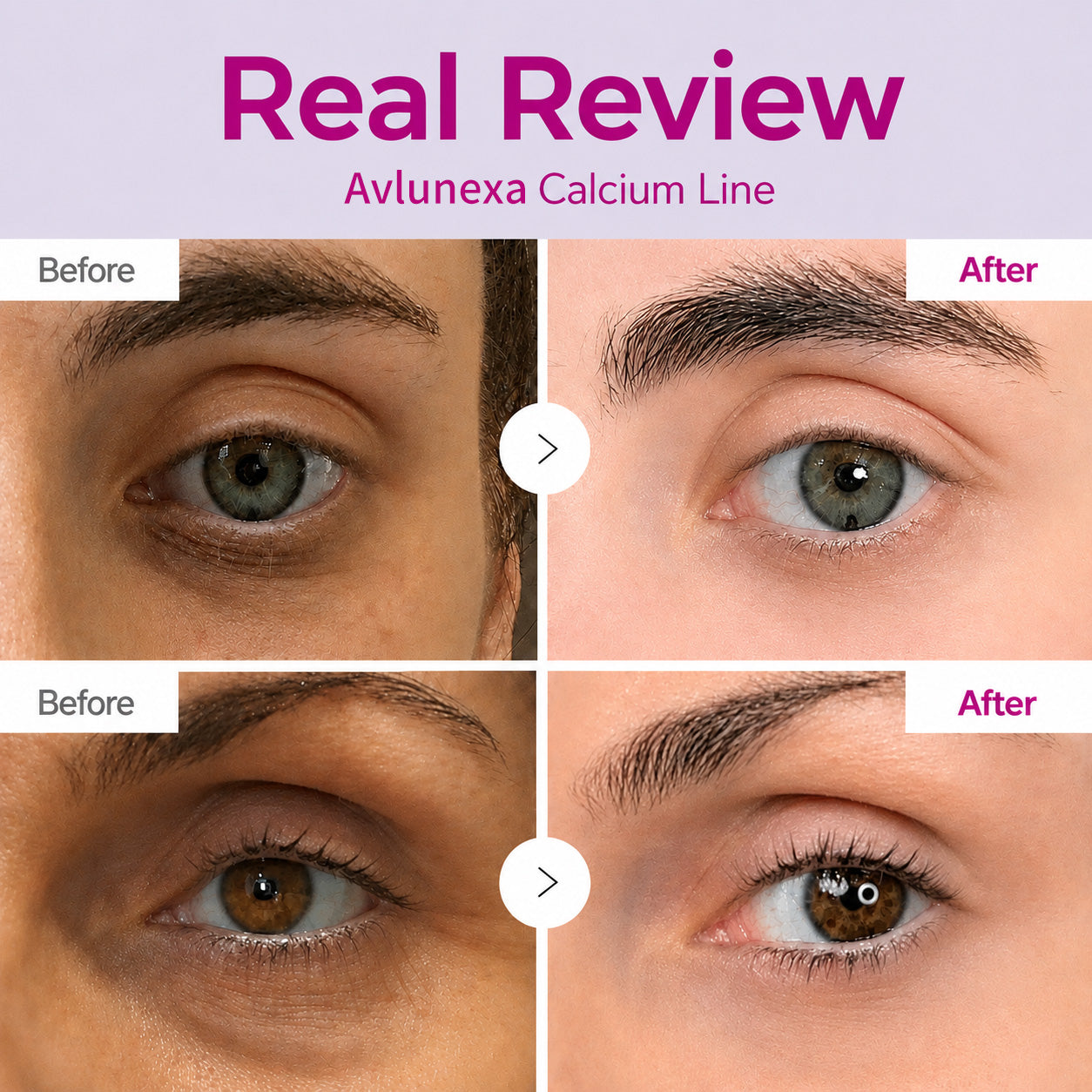 🔥LAST DAY 50% OFF!!Avlunexa Korean Calcium Dark Spot Eye Cream-ZDJ