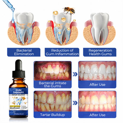 🦷Oral Repair Solution-Made for a Fresh Daily Mouth Feel-ZDJ