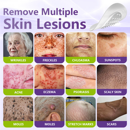 SOLUBLE MICRONEEDLE BOTANICAL SKIN TAG REMOVAL PATCH-ZDJ