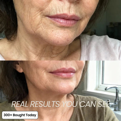 🔥🔥🔥LAST DAY 60% OFF Korean Pink Collagen Volume Multi Balm-ZDJ