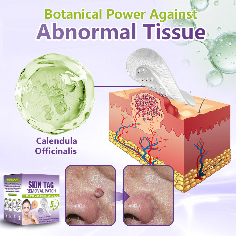 SOLUBLE MICRONEEDLE BOTANICAL SKIN TAG REMOVAL PATCH-ZDJ