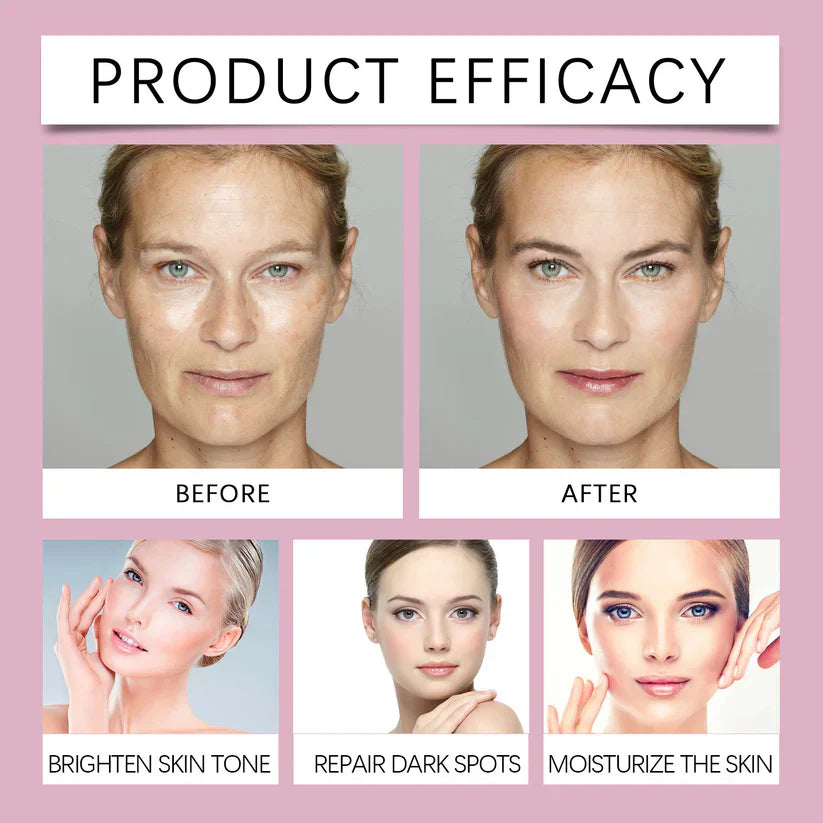 🔥Limited Time Offer🔥Advanced Dark Spot Corrector Serum -Multi-Correction Brightening Formulafor Sun Spots, Age Spots, and Melasma-ZDJ