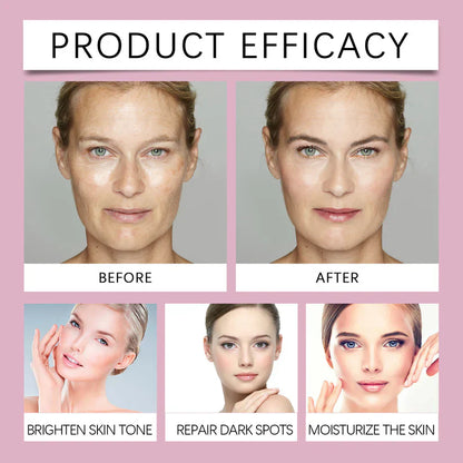🔥Limited Time Offer🔥Advanced Dark Spot Corrector Serum -Multi-Correction Brightening Formulafor Sun Spots, Age Spots, and Melasma-ZDJ