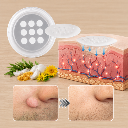 ✨2-in-1 Microneedle & Hydrocolloid Patch🍀| Removes Raised Moles, Acne, Flat Warts & Skin Tags | Helps Improve Wrinkles, Scars & Blemishes | Invisible Patches for Face & Body-ZDJ
