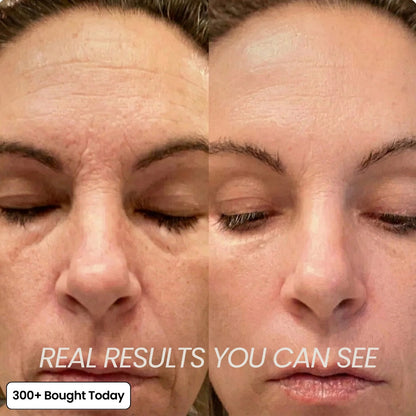 🔥🔥🔥LAST DAY 60% OFF Korean Pink Collagen Volume Multi Balm-ZDJ