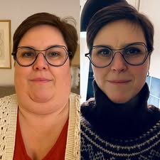 OUR+® 𝑁𝑎𝑛𝑜 𝘔𝘪𝘤𝘳𝘰𝘯𝘦𝘦𝘥𝘭𝘦 𝖯𝚊𝗍𝖼𝗁