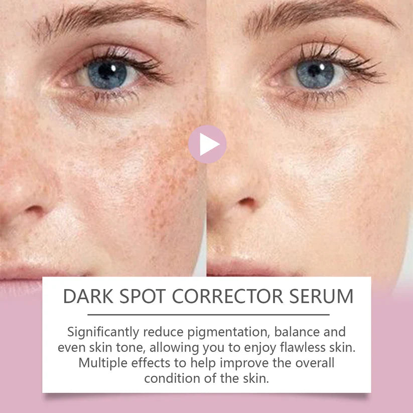 🔥Limited Time Offer🔥Advanced Dark Spot Corrector Serum -Multi-Correction Brightening Formulafor Sun Spots, Age Spots, and Melasma-ZDJ