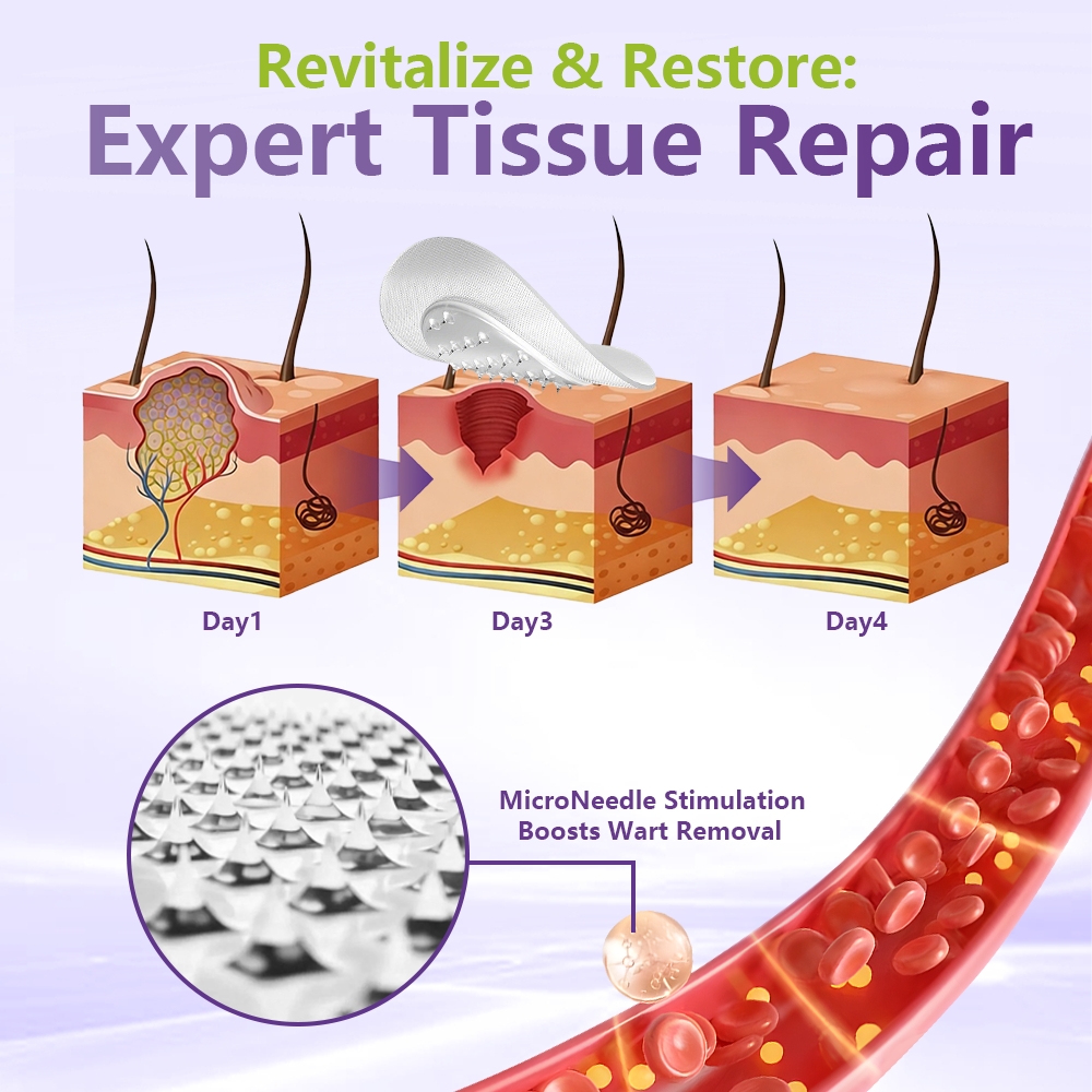 SOLUBLE MICRONEEDLE BOTANICAL SKIN TAG REMOVAL PATCH-ZDJ