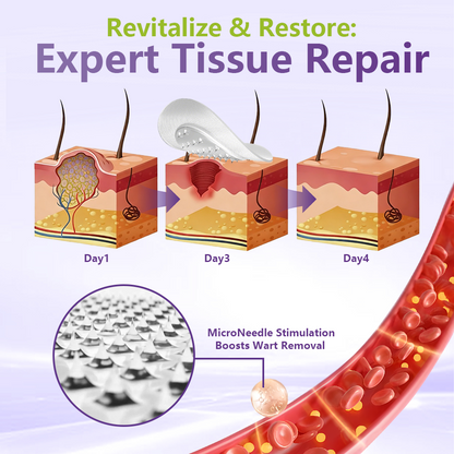 SOLUBLE MICRONEEDLE BOTANICAL SKIN TAG REMOVAL PATCH-ZDJ