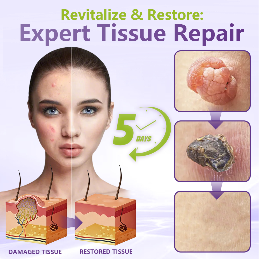 SOLUBLE MICRONEEDLE BOTANICAL SKIN TAG REMOVAL PATCH-ZDJ