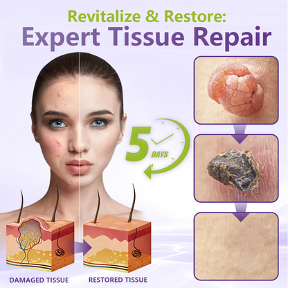 SOLUBLE MICRONEEDLE BOTANICAL SKIN TAG REMOVAL PATCH-ZDJ