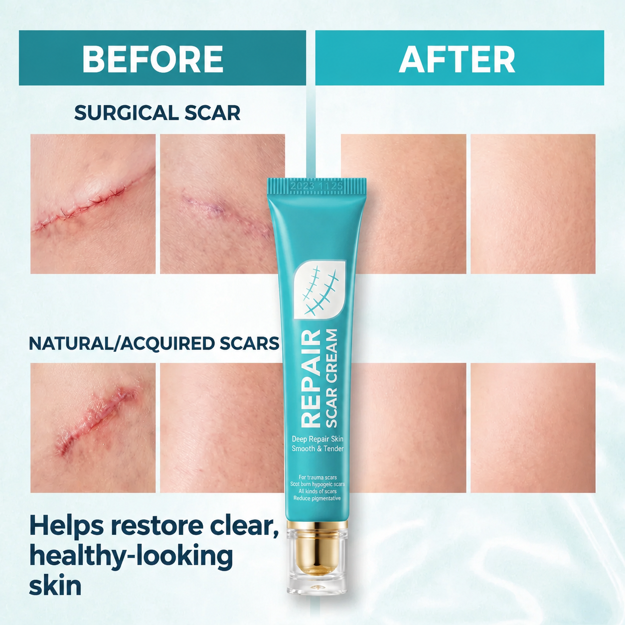🏆 Advanced Scar Repair Cream – Fade the Look of Scars & Restore Smooth, Healthy-Looking Skin ✨-CU