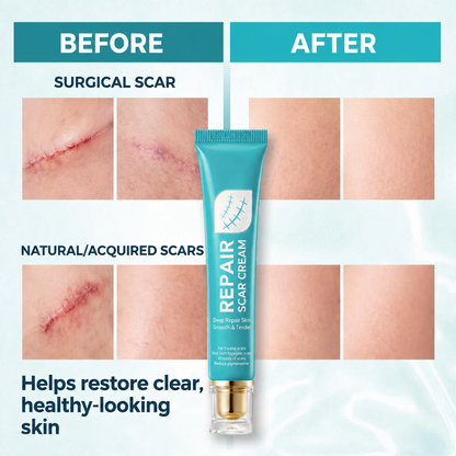 🏆 Advanced Scar Repair Cream – Fade the Look of Scars & Restore Smooth, Healthy-Looking Skin ✨-CU