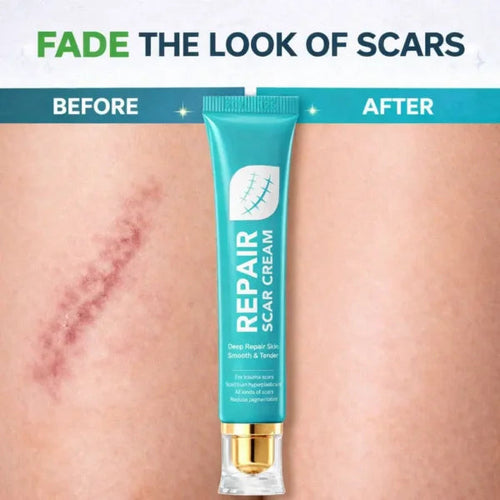 🏆 Advanced Scar Repair Cream – Fade the Look of Scars & Restore Smooth, Healthy-Looking Skin ✨-CU