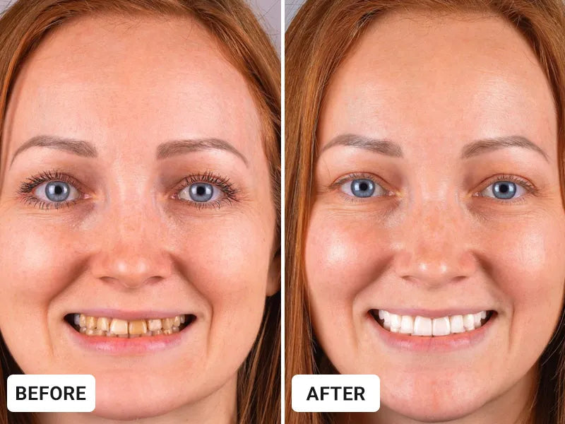 🦷Oral Repair Solution-Made for a Fresh Daily Mouth Feel-ZDJ
