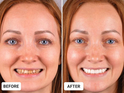🦷Oral Repair Solution-Made for a Fresh Daily Mouth Feel-ZDJ