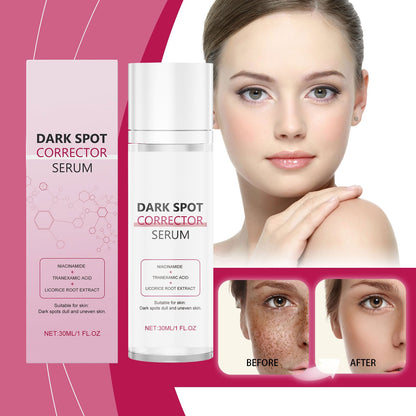 🔥Limited Time Offer🔥Advanced Dark Spot Corrector Serum -Multi-Correction Brightening Formulafor Sun Spots, Age Spots, and Melasma-ZDJ
