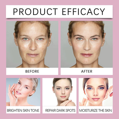 🔥Limited Time Offer🔥Advanced Dark Spot Corrector Serum -Multi-Correction Brightening Formulafor Sun Spots, Age Spots, and Melasma-ZDJ