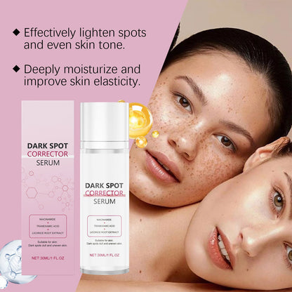 🔥Limited Time Offer🔥Advanced Dark Spot Corrector Serum -Multi-Correction Brightening Formulafor Sun Spots, Age Spots, and Melasma-ZDJ