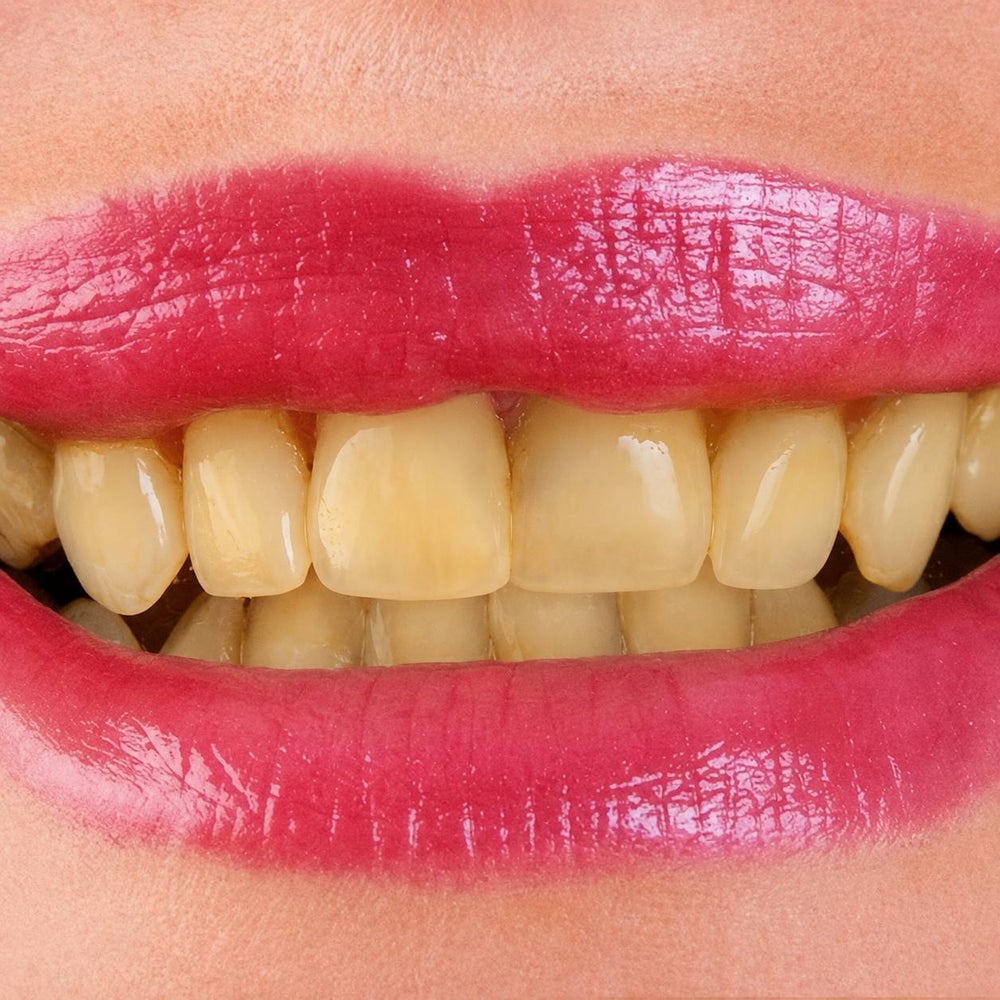 Pure'Aera Purple Mouthwash™ image 8